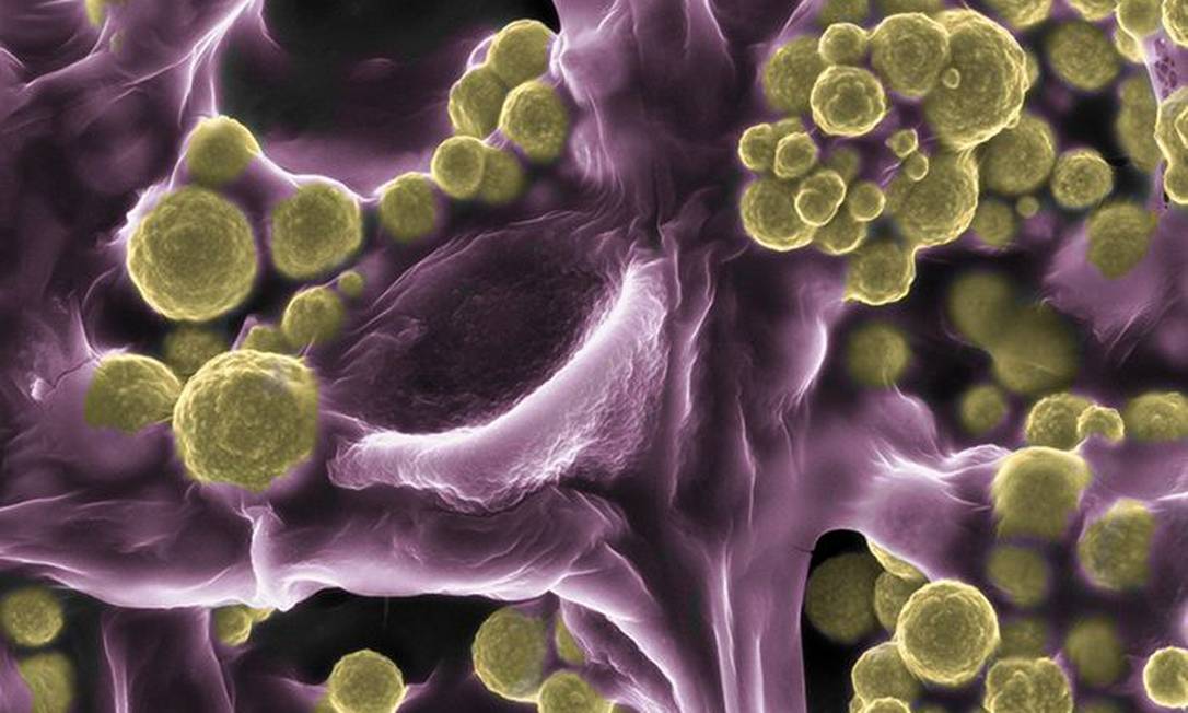 Imagem colorida de microscópio eletrônico de varredura mostra um fungo do grupo Fusarium oxsporium, que fixa microscópicas "bolas de ouro" em seus fios, cientistas compararam a "enfeites em uma árvore de Natal" Foto: CSIROscope/ Divulgação