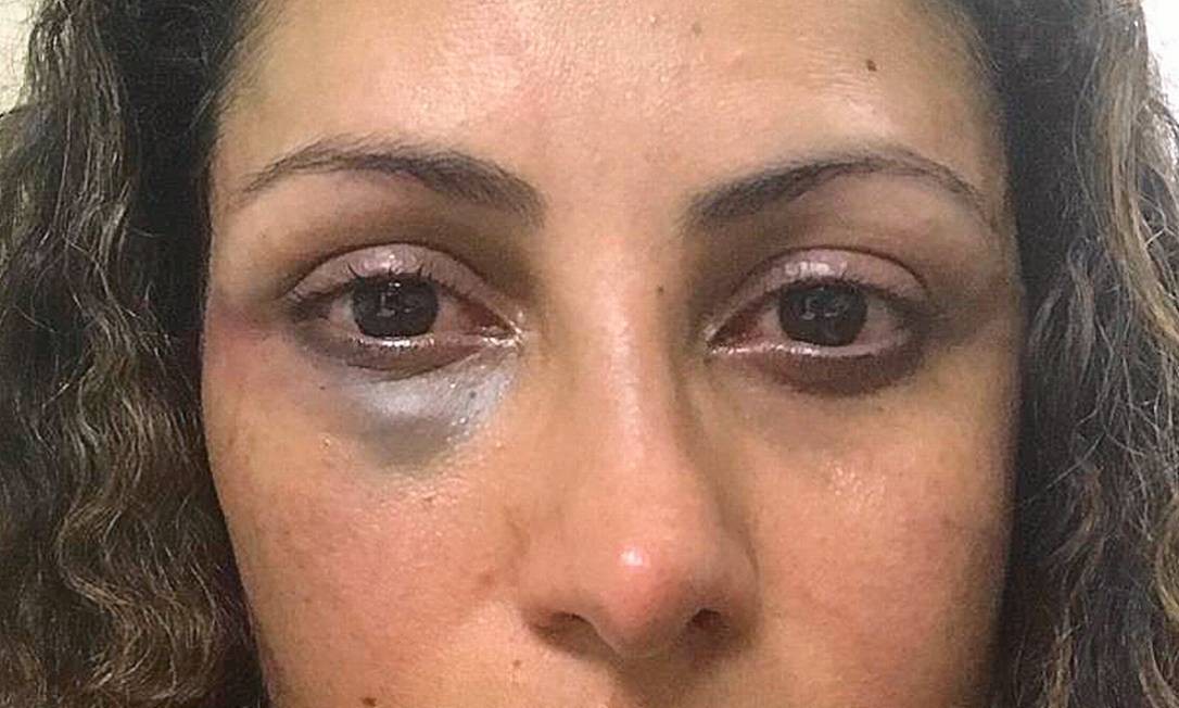 Élida Souza Matos, em foto tirada pela filha no dia da agressão. Foto: Reprodução