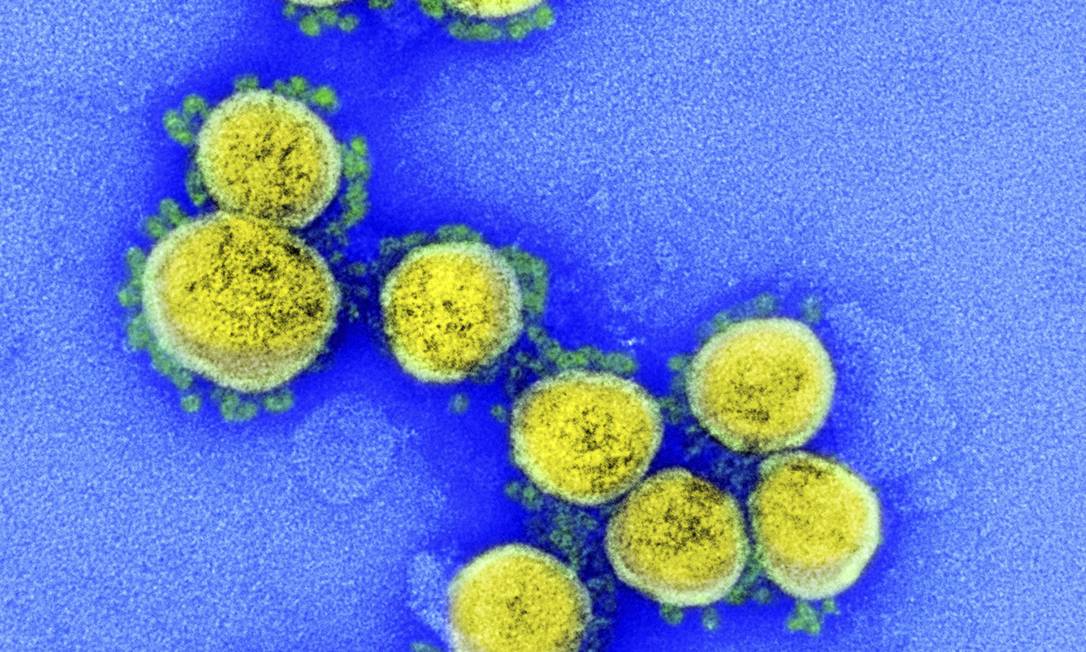 A transmissão do vírus sars-CoV-2, como captado pela micrografia eletrônica, está mais acelerada em nova variante identificada na Inglaterra. Foto: IMAGE POINT FR / NIH / NIAID / BSIP / Universal Images Group / Getty Images