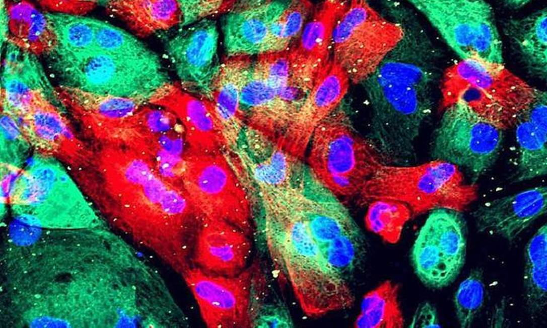 
Célula cancerígena vista de um microscópio
Foto: Divulgação/National Cancer Institute