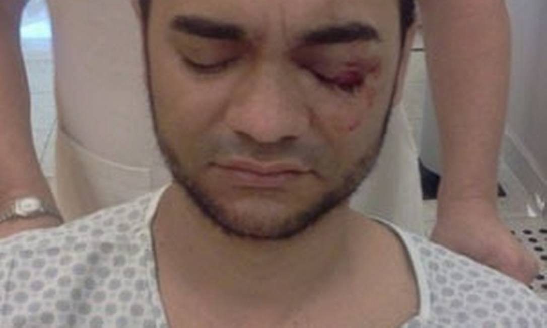 
O fotógrafo Sérgio Silva foi atingido por um tiro de uma bala de borracha durante os protestos de junho de 2013
