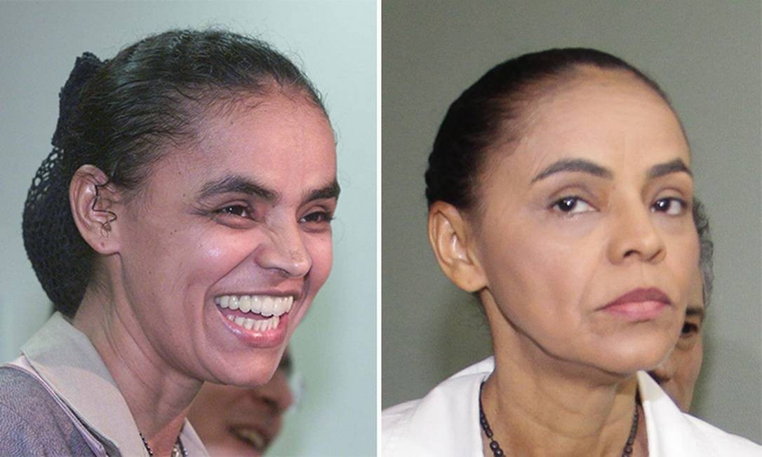 De transplante de cabelo a botox, o que os candidatos têm feito para