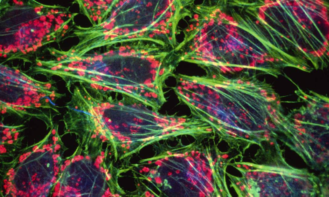 
Células cancerígenas. Multiplicação descontrolada seria decorrente de ‘má sorte’, segundo estudo
Foto:
Latinstock
