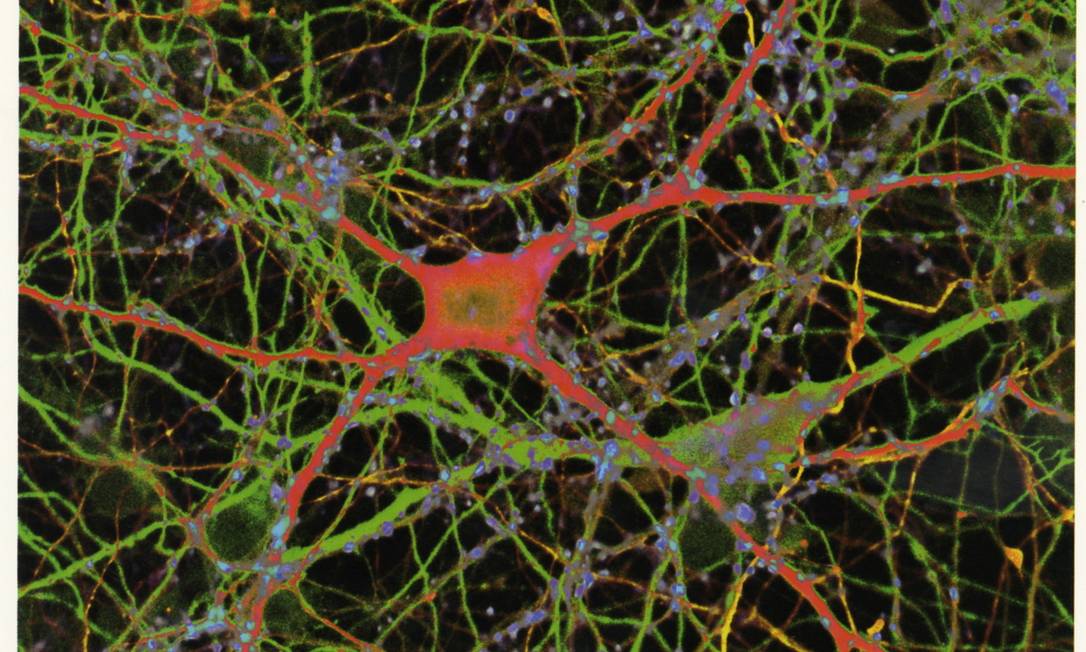 A doença de Parkinson é causada pela degeneração e morte de neurônios produtores de dopamina no cérebro
Foto: Agência O Globo