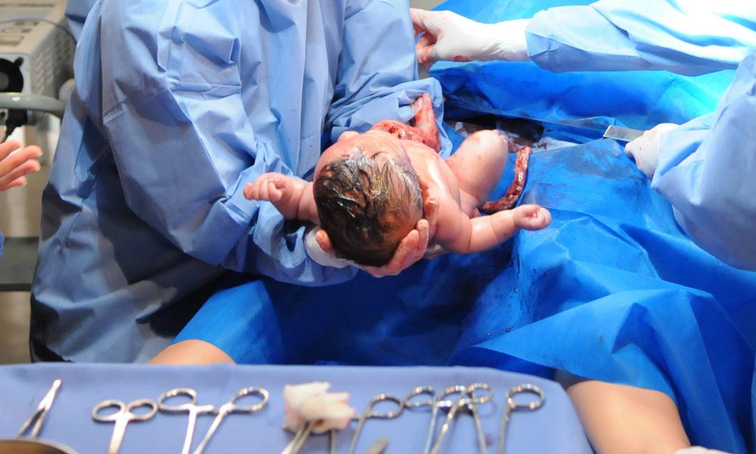 
Ingestão de placenta após o nascimento do bebê não traria benefícios, diz estudo
Foto:
/
Arquivo
