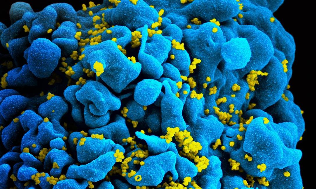 
Vírus HIV: combate agora deve ser com doses preventivas, diz OMS
Foto:
NIAID. CC BY 2.0. https://flic.kr/p/bo5nY2
/
Arquivo
