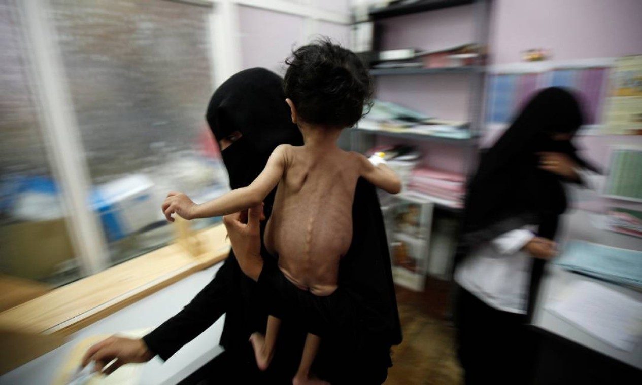 Uma mulher segura o filho, após ser pesado no hospital de cuidados intensivos para desnutridos em Sanaa Foto: KHALED ABDULLAH / Agência O Globo