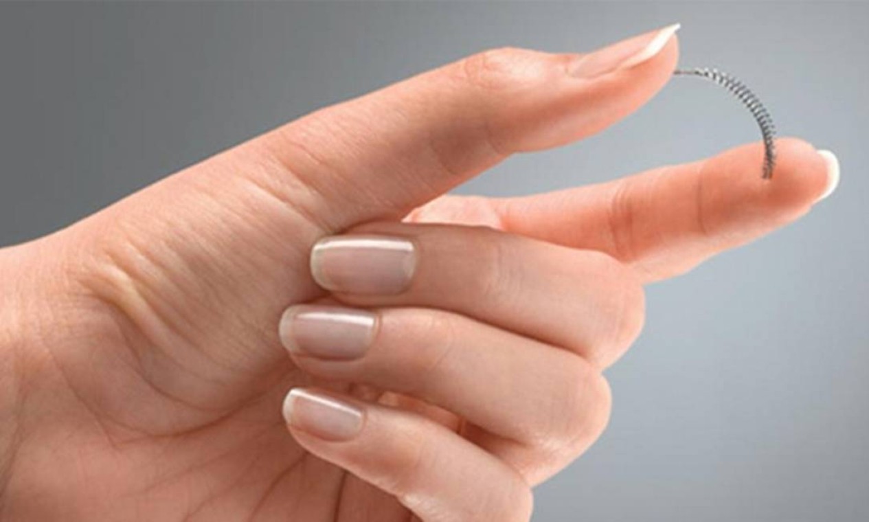 Anvisa suspende anticoncepcional Essure 'risco máximo' Jornal O Globo