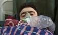 66133987_A-Syrian-man-receives-treatment-at-a-small-hospital-in-the-town-of-.jpg