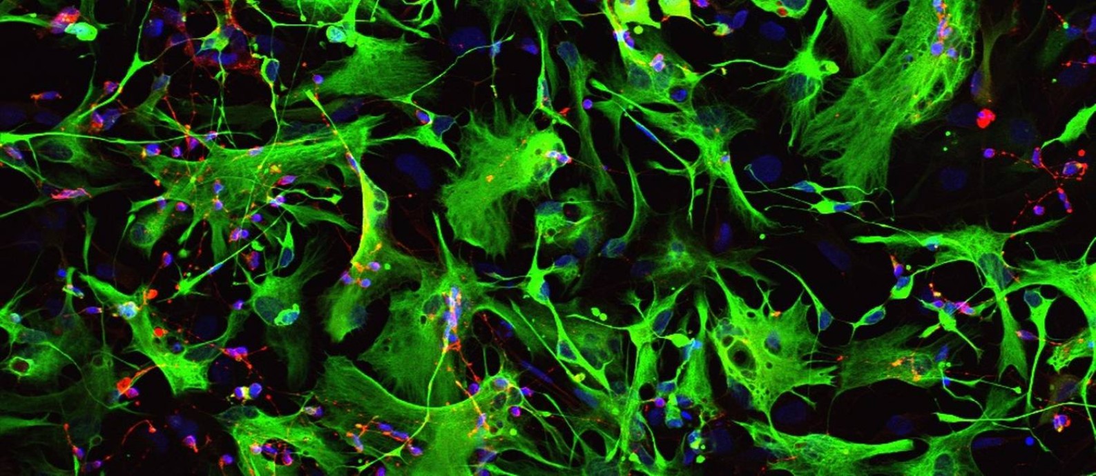 
Astrócitos, as células nervosas mais abundantes, foram reprogramadas no experimento
Foto:
/
REPRODUÇÃO/AXOLBIO
