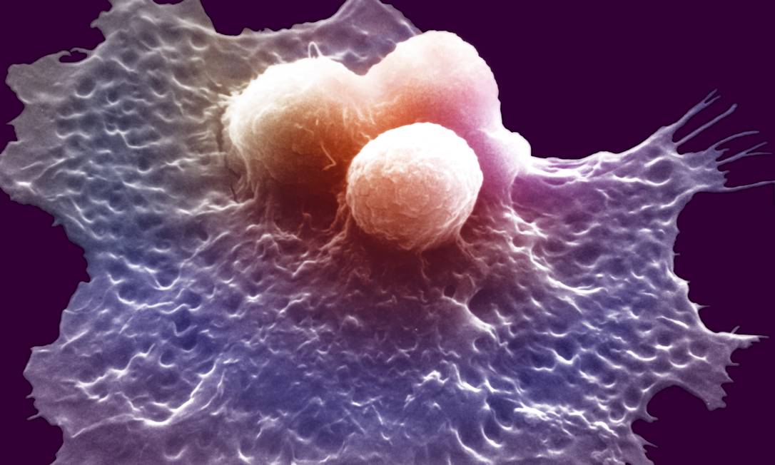 Células cancerosas no sangue Foto: Latinstock/Science VU/W. J. Johnson