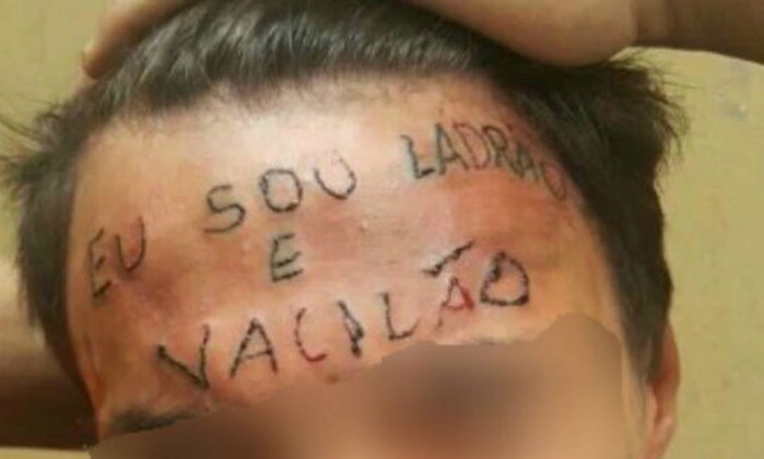 Resultado de imagem para Jovem de 17 anos tatuado na testa se prepara para cirurgia de remoção em São Paulo