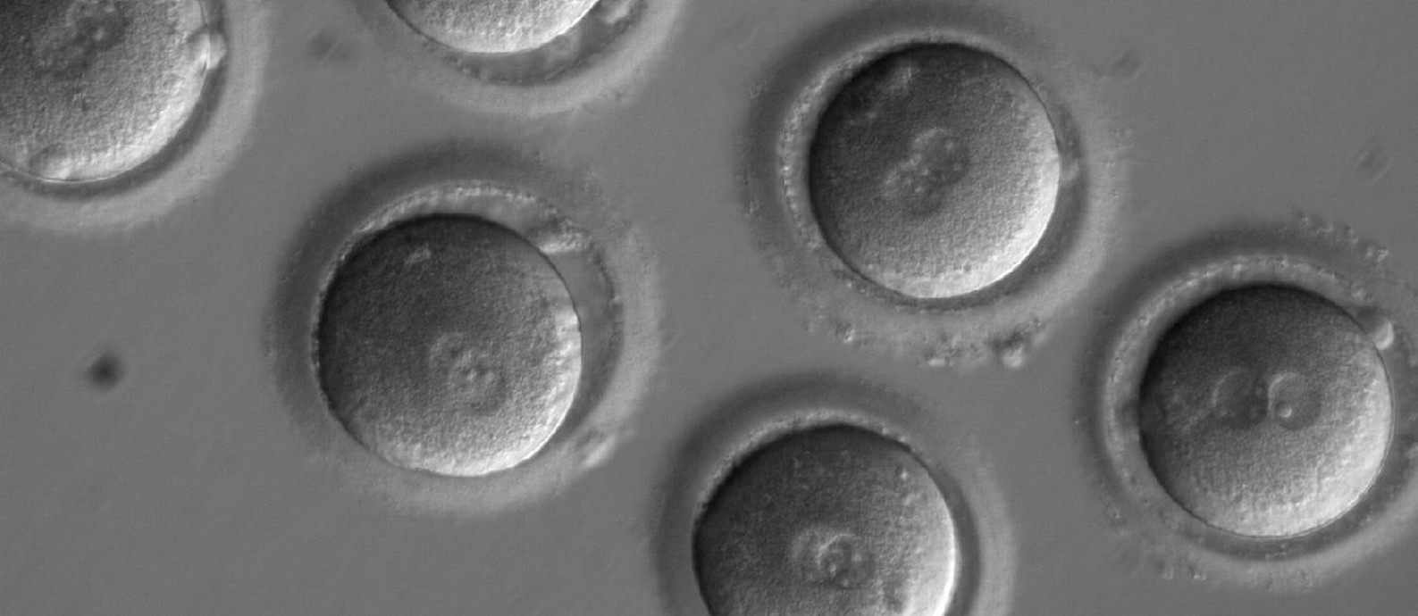 
Imagem mostra ovócitos logo após a inseminação com o espermatozoide e a injeção do CRISPR-Cas9
Foto:
/
OHSU/NATURE
