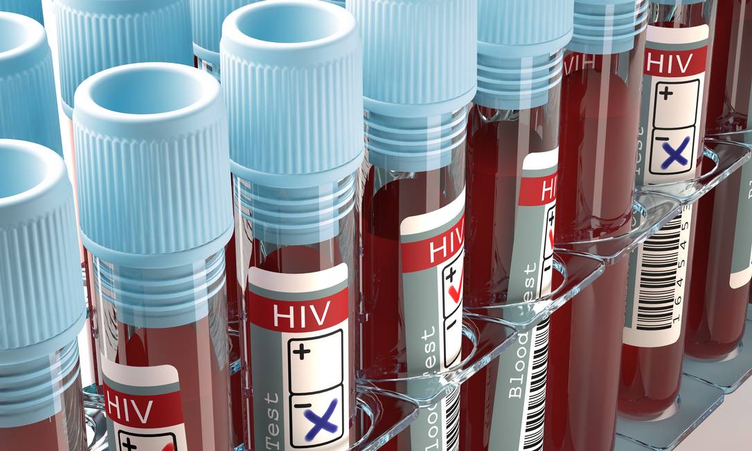
Testes de HIV: acesso é importante para enfrentar problema
Foto:
Shutterstock
