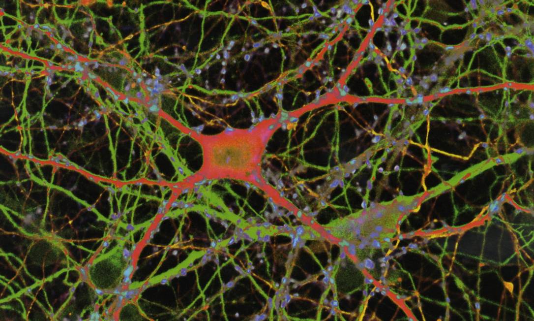 
Ilustração mostra redes de neurônios no cérebro: na esclerose múltipla, células são atacadas pelo sistema imunológico do próprio paciente
Foto:
Reprodução
