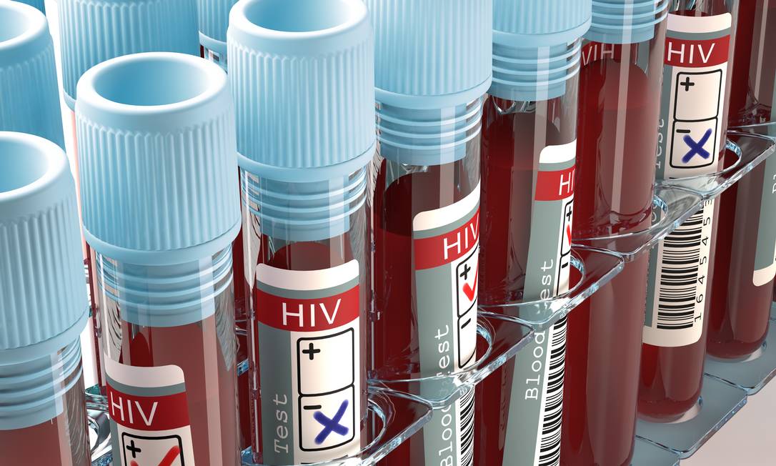 
Ampolas de sangue para testagem de HIV: pesquisas são fundamentais no combate à epidemia de Aids
Foto:
Shutterstock
