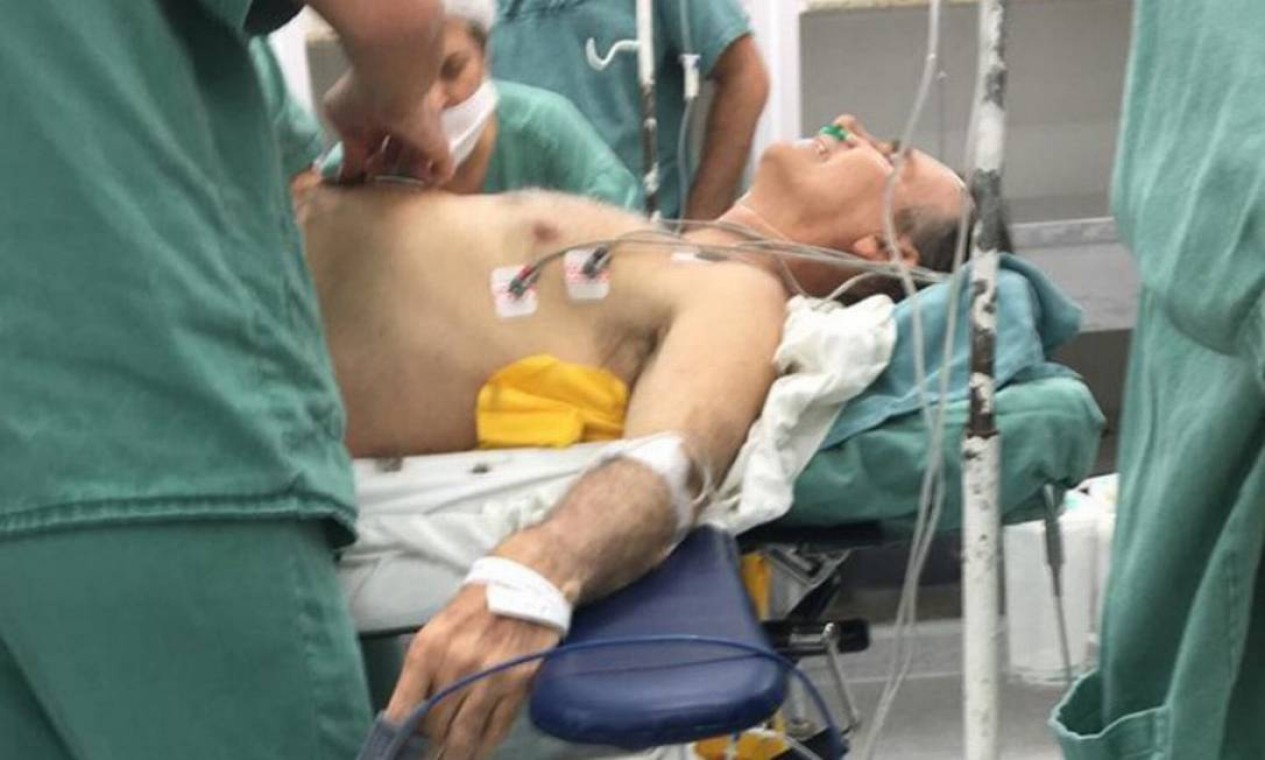 Desde a facada, Bolsonaro usa uma bolsa de colostomia em função de lesões graves nos intestinos Foto: Reprodução