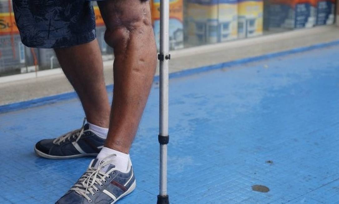
Mais de 200 mil aposentadorias por invalidez foram canceladas após o pente-fino
Foto:
/
Arquivo- Agência O Globo
