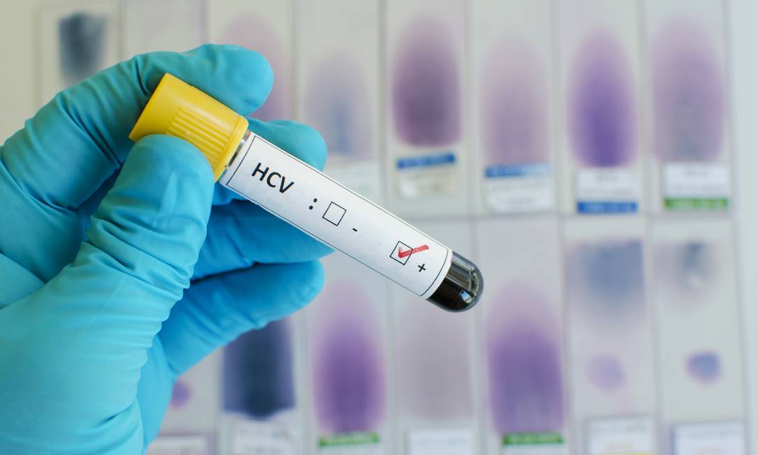 
Teste de hepatite C: ampliação do diagnóstico é quarta intervenção com potencial de forte efeito no fim da epidemia da doença
Foto:
Shutterstock
