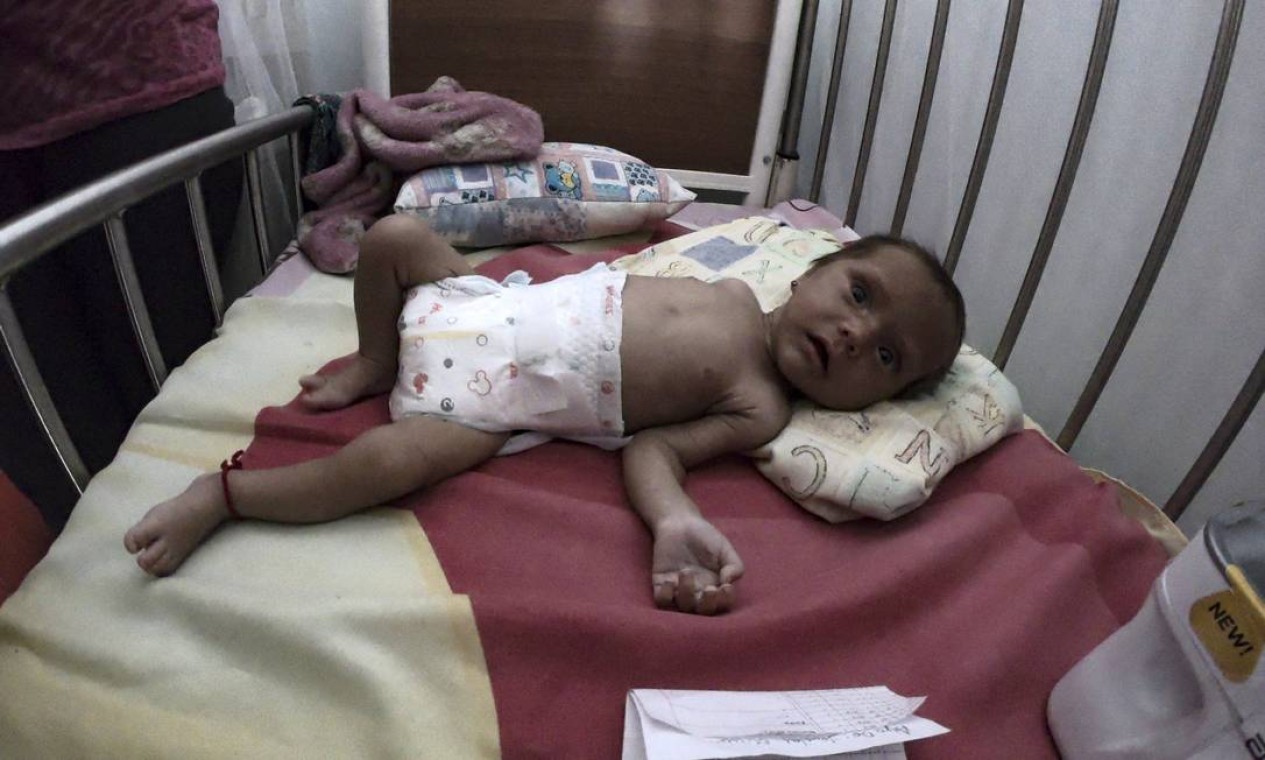 Um bebê desnutrido permanece em um leito de hospital em Maracay, estado de Aragua, Venezuela. A falta de alimentos é agravada pela inflação, que em 2018 passou de 1.000.000% Foto: YURI CORTEZ / AFP