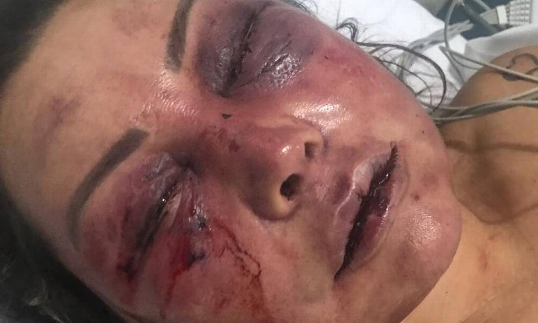 A paisagista Elaine Caparróz, 55 anos, foi agredida por quatro horas dentro de seu apartamento, na Barra da Tijuca, na madrugada de sábado, durante seu primeiro encontro com o estudante de Direito Vinícius Serra, de 27 anos Foto: Arquivo pessoal