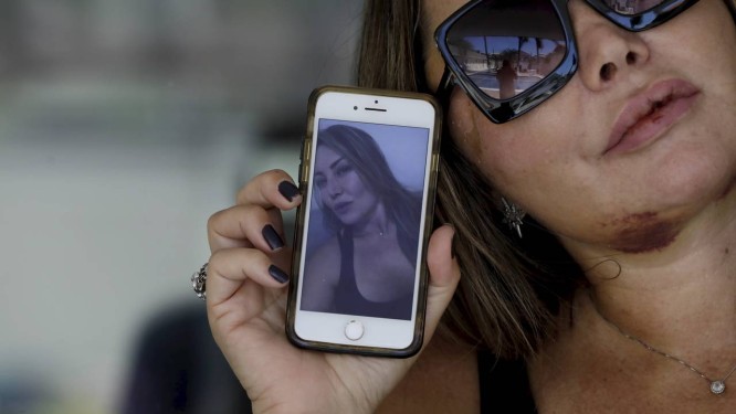 Resultado de imagem para paisagista agredida quer mudar de casa