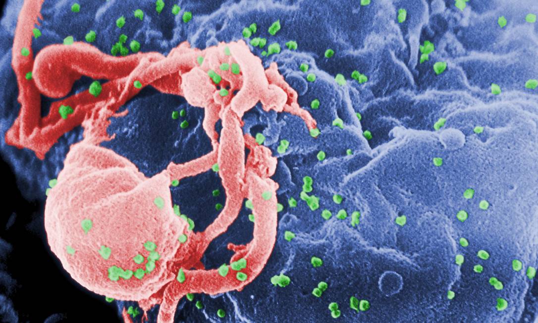Vírus HIV tornou-se indetectável em exames de paciente britânico
Foto: Latinstock