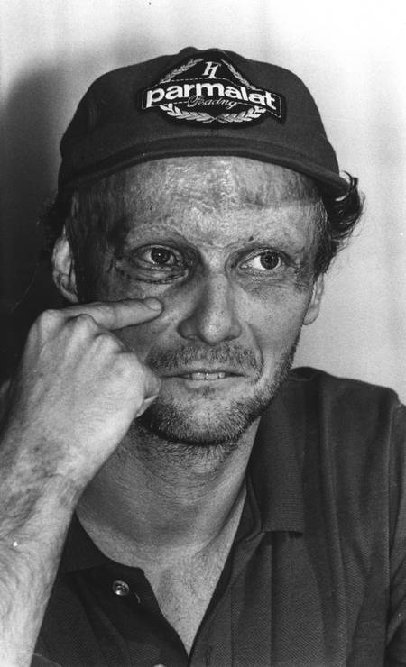 Arquivo 18/01/1983, - Niki Lauda fala de sua cirurgia em coletiva no Hotel Sheraton no Rio de Janeiro Foto: Luiz Pinto / AOG