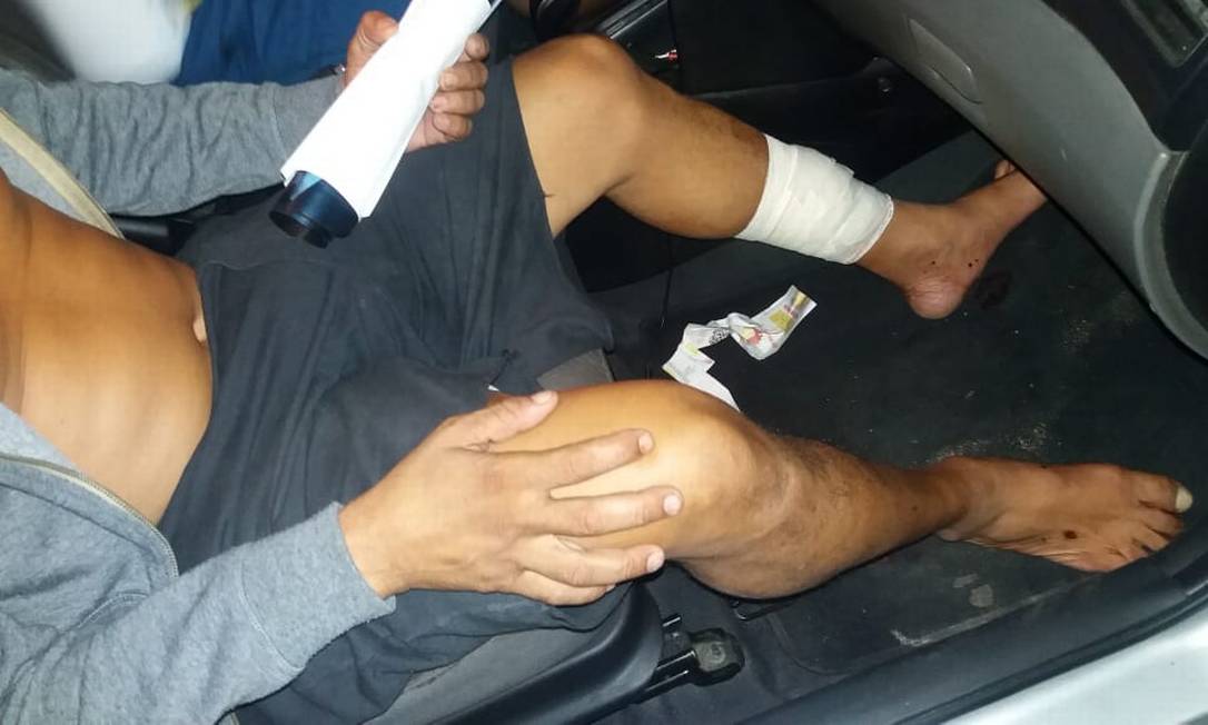 Vítima baleada em São Gonçalo com curativos na perna Foto: Reprodução