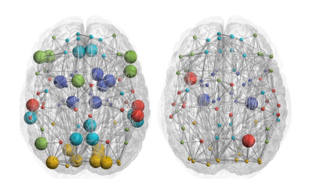 Como o cérebro dos jogadores de futebol é diferente do de outros