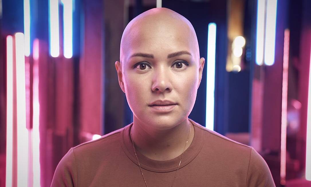 Liliya diz que sofreu bullying por ter alopecia areata, uma condição que causa perda de cabelo Foto: BBC Russia
