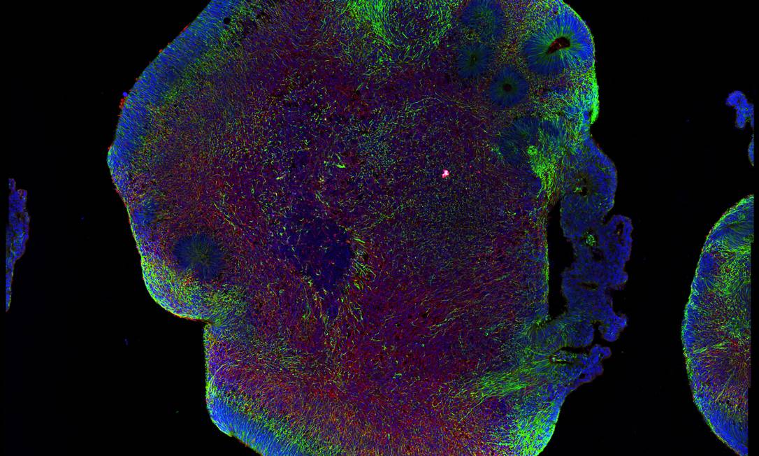 Imagem de tecido cerebral humano desenvolvido em laboratório infectado pelo vírus da zika Foto: Divulgação
