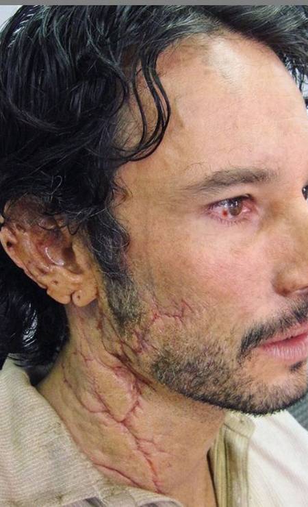 Rodrigo Santoro relembra dia em que 'perdeu' pedaços da orelha em filme