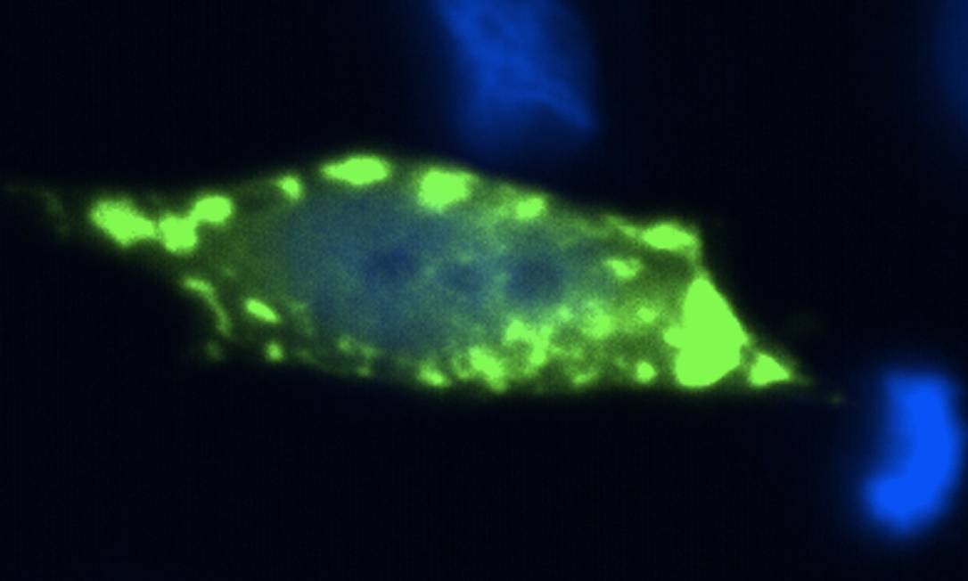 Imagem de microscópio mostra neurônio com acúmulo de Sod1, proteína envolvida na ocorrência de esclerose lateral amiotrófica, doença neuromotora que provoca paralisia Foto: Eleutherio et al. / PNAS