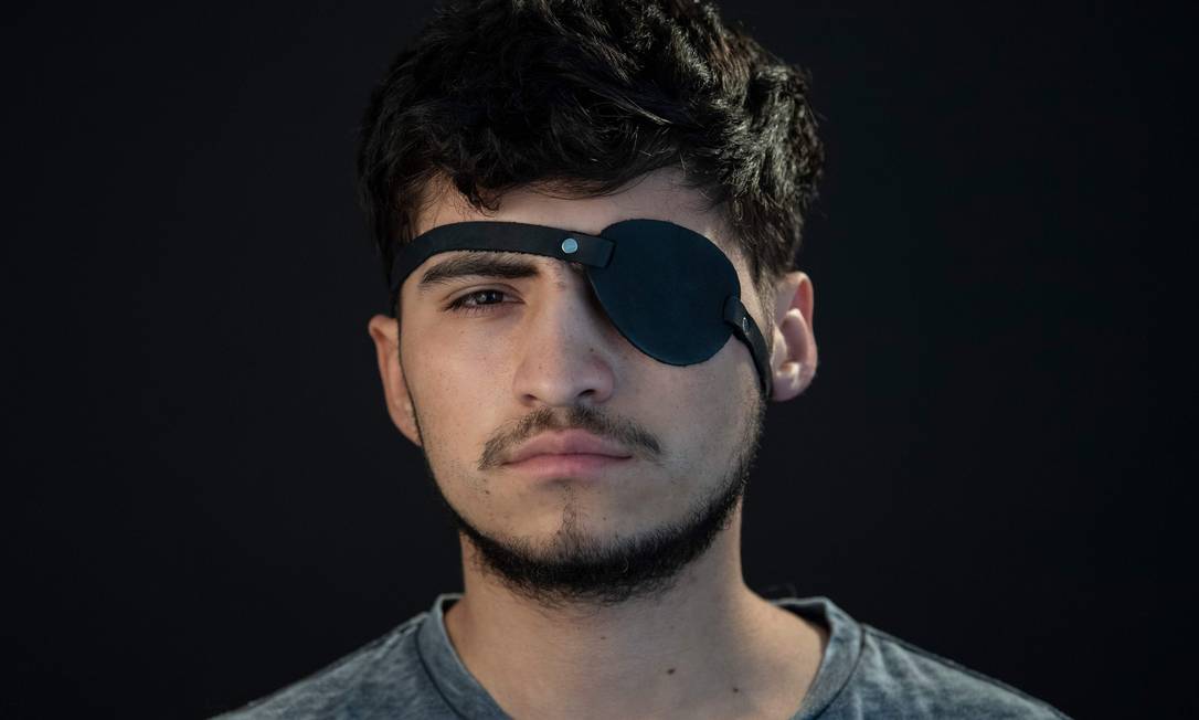 Estudante chileno Diego Foppiano, de 22 anos, foi acertado no olho durante protestos em Santiago, em outubro. Foto: MARTIN BERNETTI / AFP