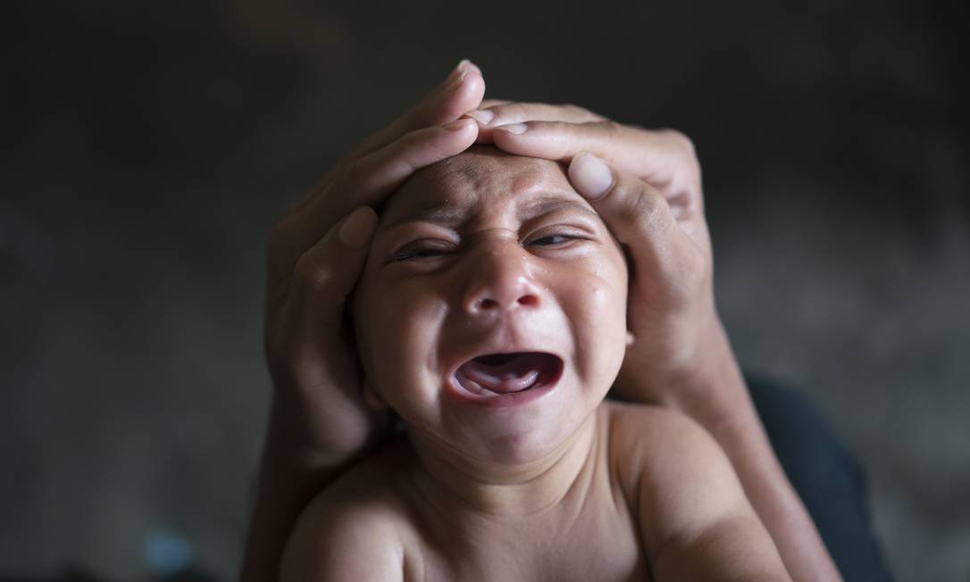 Criança com microcefalia na cidade de Bonito (PE); estudo da UFRJ mostra que desnutrição é um dos fatores que podem levar a piora dos problemas derivados da infecção pelo vírus da zika Foto: Felipe Dana/AP Photo/30-1-16