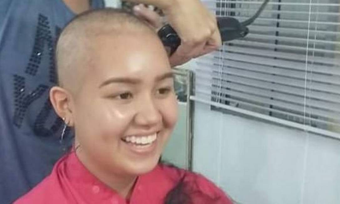 Durante tratamento contra o câncer, jovem teve de raspar o cabelo Foto: Reprodução