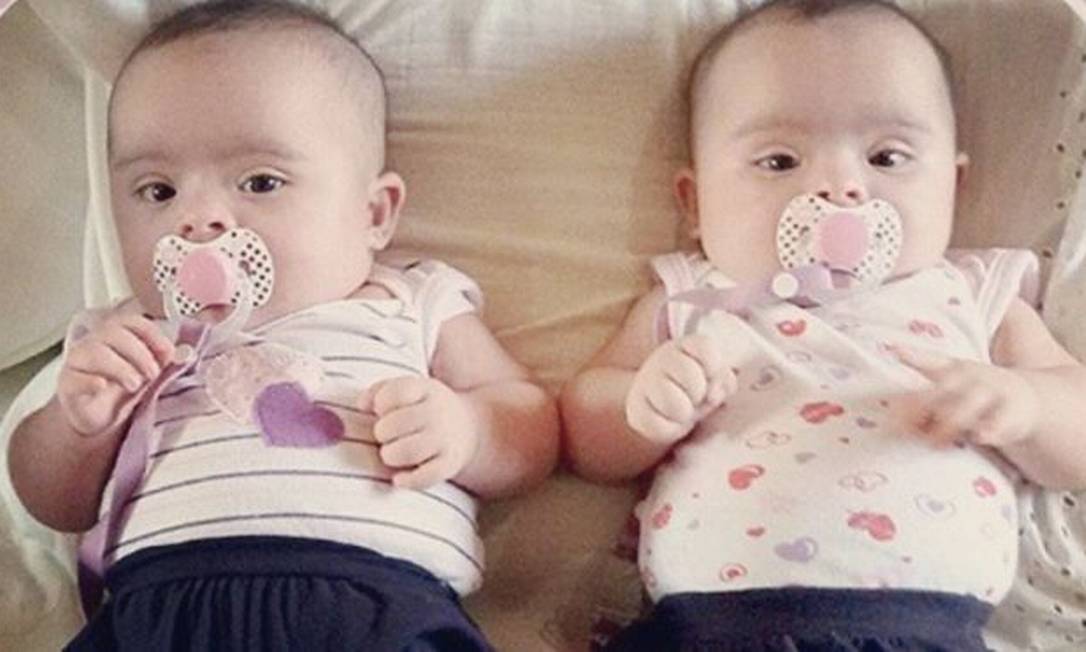'Descobri um mês depois do parto que minhas gêmeas têm síndrome de Down' Época