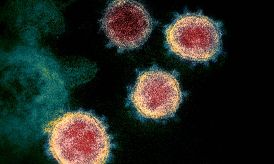 Imagem de microscópio eletrônico colorizada artificialmente mostra unidades de coronavírus COVID-19 emergindo de célula de paciente infectado nos EUA Foto: NIAID/RML/NIH
