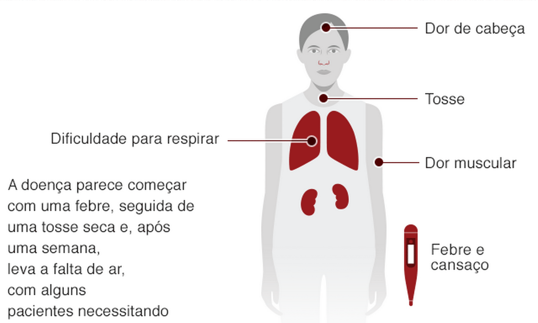 Coronavírus: 25 perguntas e respostas para entender tudo que importa ...