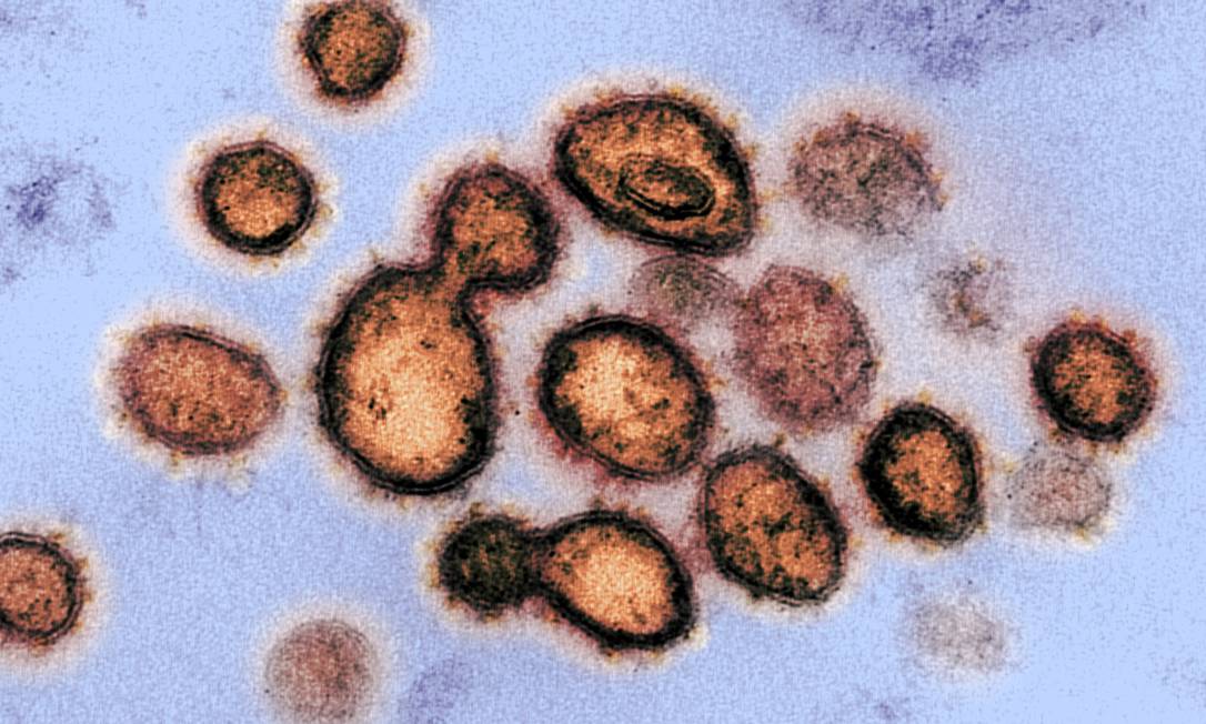 Imagem de microscópio eletrônico mostra unidades de coronavírus emergindo de célula de paciente infectado nos EUA Foto: NIAID/RML/NIH