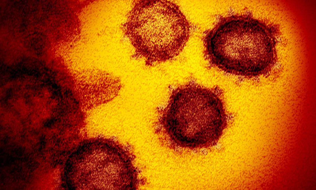 Imagem microscópica do Sars-CoV-2, o coronavírus Foto: NIAID-RML