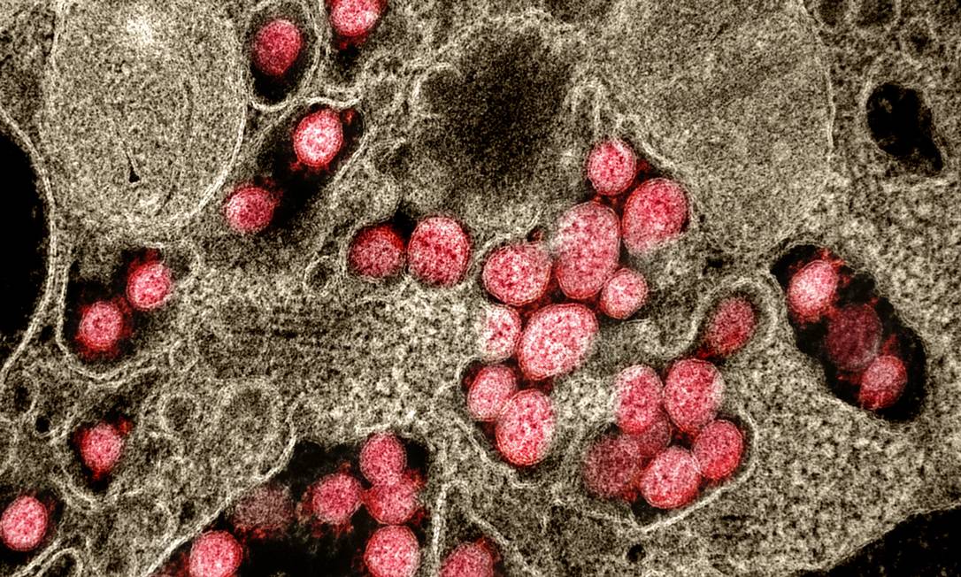 Unidades do novo coronavírus Sars-CoV-2 (em vermelho), causador da epidemia de Covid-19, numa imagem de microscópio eletrônico Foto: NIAID-NIH