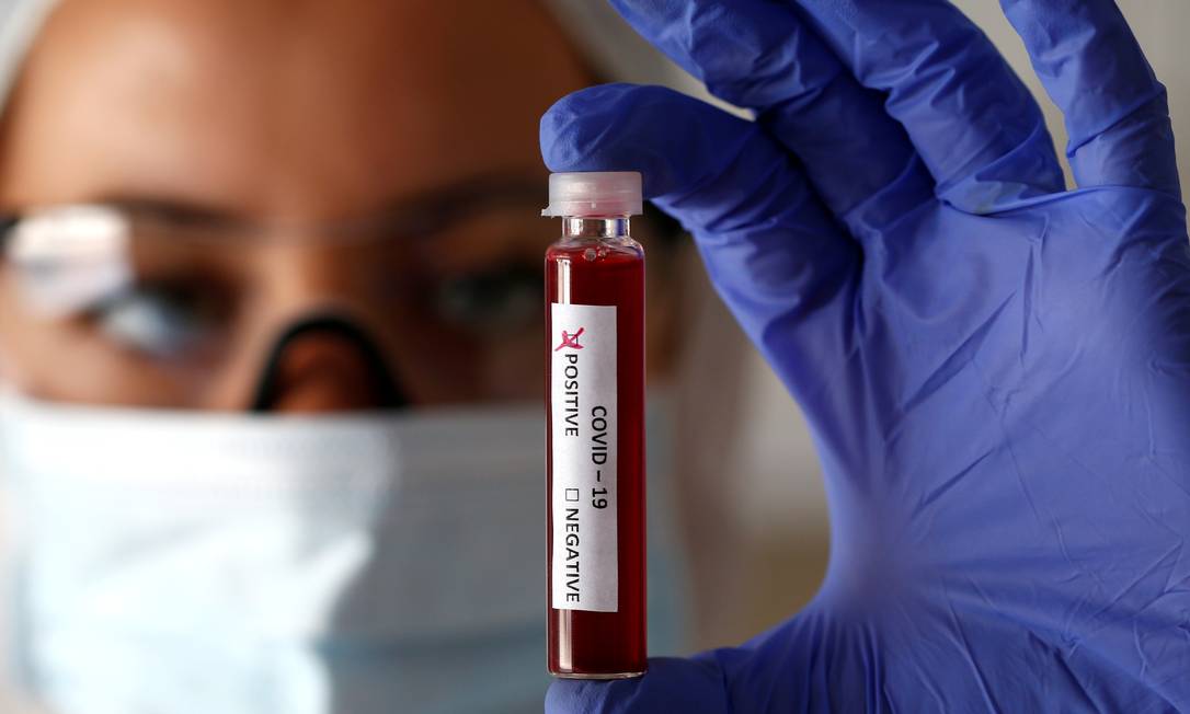 Teste para verificar se a pessoa está ou não infectada por covid-19 Foto: Dado Ruvic / Reuters
