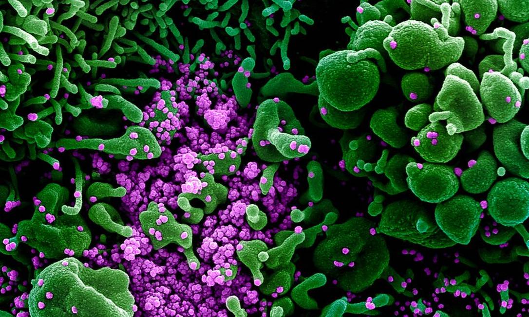 Coronavírus em célula humana Foto: National Institute of Allergy and Infectious Diseases-Rocky Mountain Laboratories, NIH