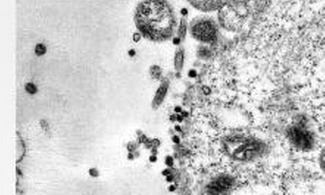 Imagens inéditas flagram momento exato da infecção do novo coronavírus em célula Foto: Reprodução