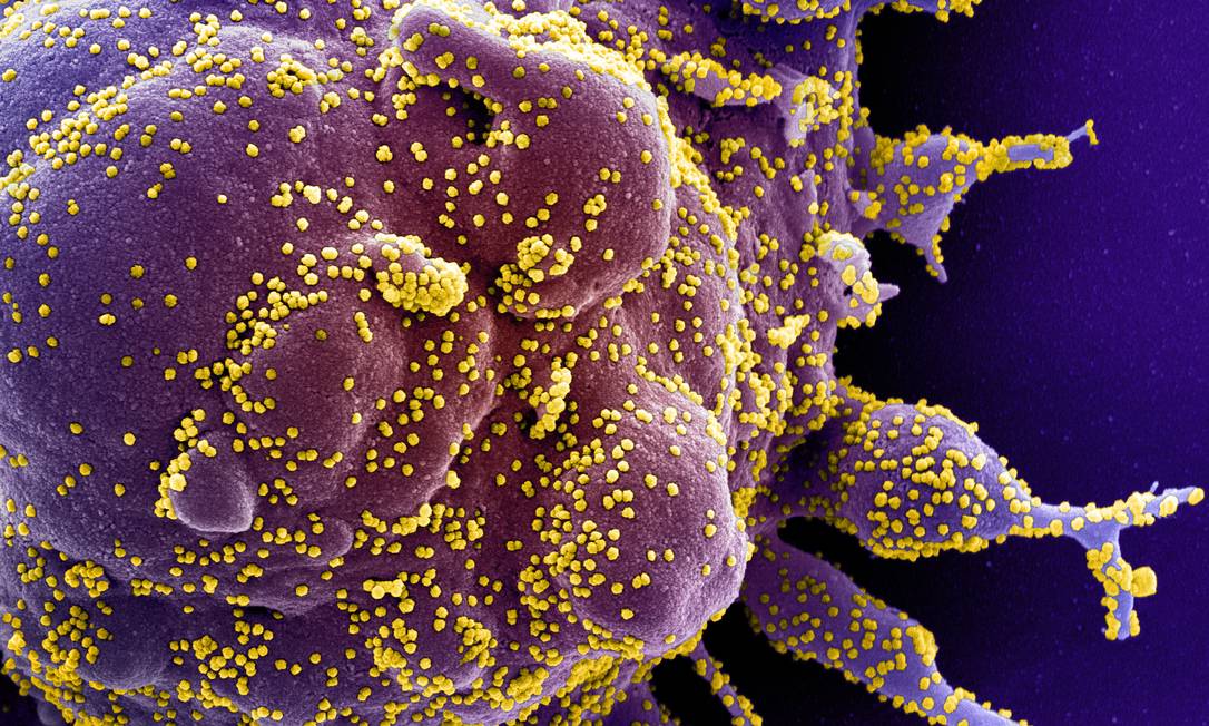 Imagem de microscópio eletrônico de varredura mostra célula humana infecada pelo SARS-CoV-2, o coronavírus da Covid-19 (partículas amarelas) Foto: NIAID-NIH