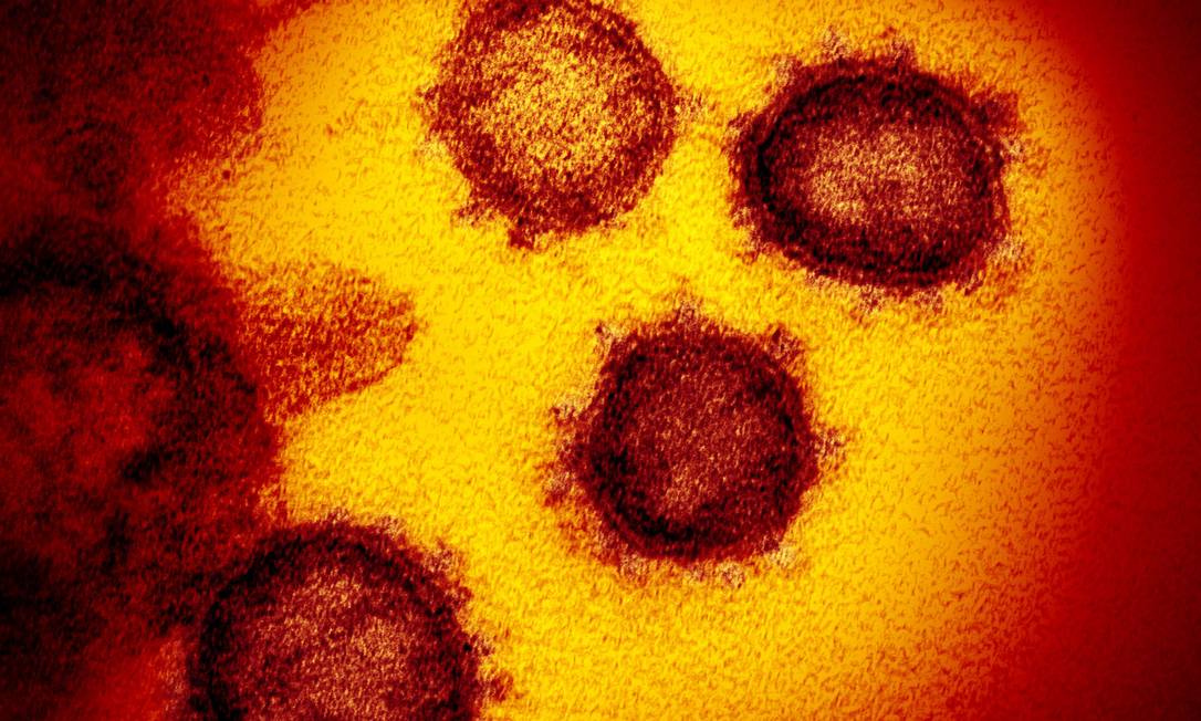 Imagem do microscópio eletrônico de transmissão mostra o SARS-CoV-2 - também conhecido como 2019-nCoV, o vírus que causa o COVID-19. Foto: Divulgação/NIAID-RML / Agência O Globo