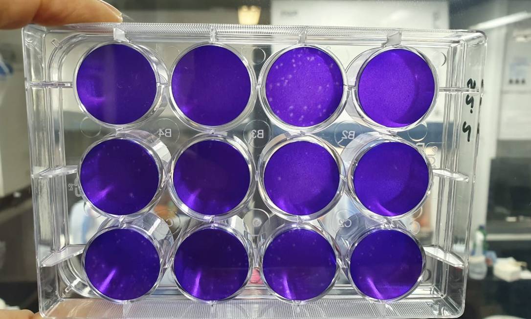 Placas do teste de anticorpos neutralizantes feito pela UFRJ para selecionar doadore Foto: Ana Lucia Azevedo