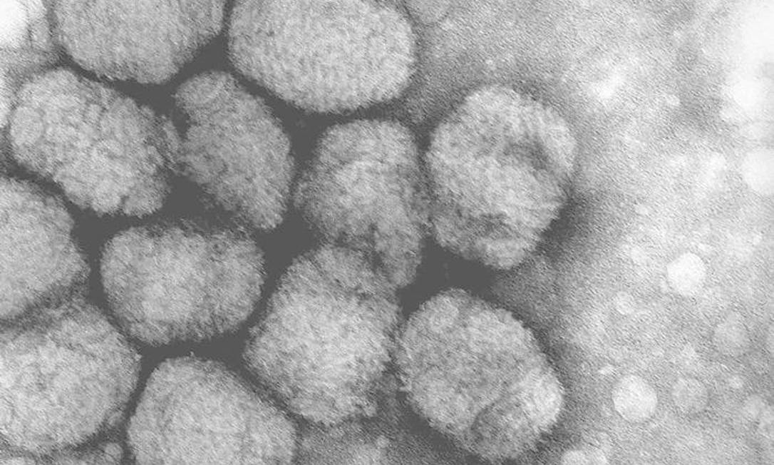 Imagem do patógeno feita por microscópio. Foto: - / AFP